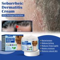 【CW】 50g Hair Psoriasis Seborrheic Treatments Dermatitis Eczema Shampoo Pruritus Scalp Creams