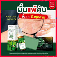 ส่งฟรี || สเปรย์สมุนไพร&amp;สบู่ว่านรางจืด แก้อาการคัน ผด ผื่น เหงื่อเยอะ กลิ่นตัว เชื้อรา กลากเกลื้อน สะเก็ดเงิน สังคัง เชื้อราหนังศรีษะ