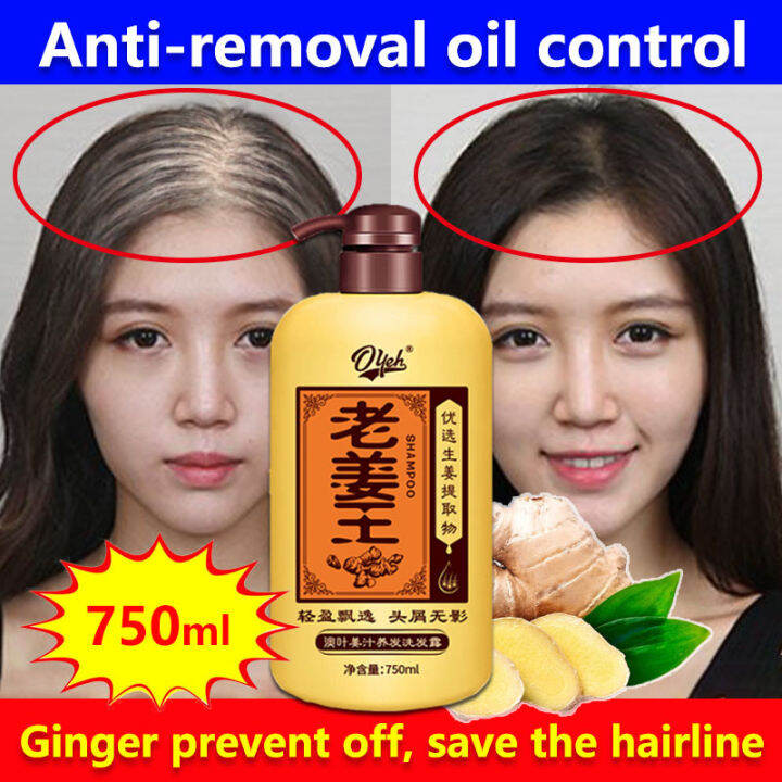 Ginger shampoo Hair growth shampoo 750ml Anti dandruff shampoo Anti