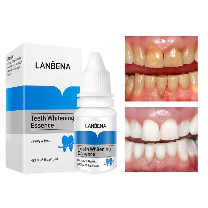 Tooth stain removal artifact Smoke stains to yellow the latest dental