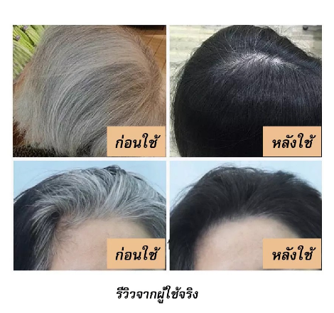 แชมพูปิดผมหงอกสมุนไพร-ปิดผมหงอกเปลี่ยนสีผมใน-5-นาที-สูตรพิเศษเปลี่ยนสีผมจากสีขาวให้กลายเป็นสีธรรมชาติได้อย่างง่ายดาย-ไม่มีกลิ่นฉุน-แชมพูเปลี่ยนสีผมดีที่สุดสำหรับผู้ที่มีปัญหาผมหงอกหรือขาว