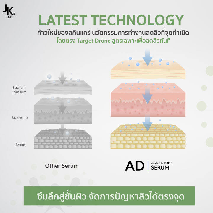 jkxlab-ad-acne-drone-serum-30-ml-เซรั่มสูตรเฉพาะเพื่อการลด-สิวอย่างรวดเร็ว-สัมผัสความแตกต่างได้ตั้งแต่คืนแรก