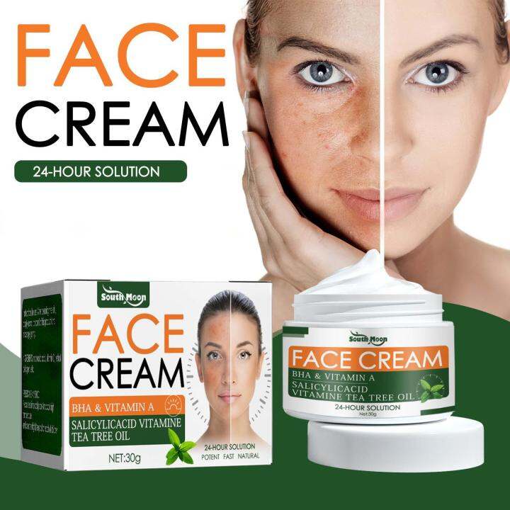 Effective Acne Removal Face Cream Herbal Anti Acne Pores Moisturizer