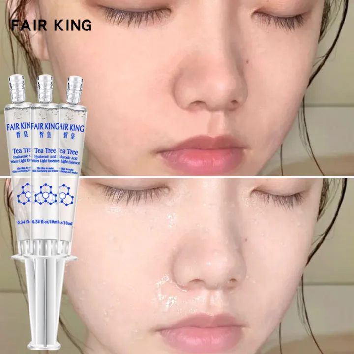 FAIR KING 3PCS ทีทรี กรดไฮยาลูโรนิก เซรั่มหน้าใส ให้ความชุ่มชื้น