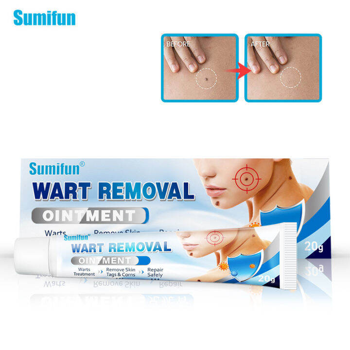 【COD】Sumifun Wart Removal Cream Repair Cream Foot Care Cleans the skin