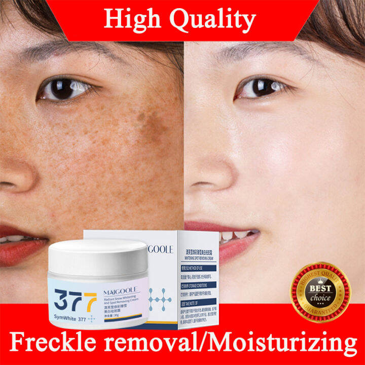 Nicotinamide Whitening Freckle Cream Original Melasma Cream Pekas ...