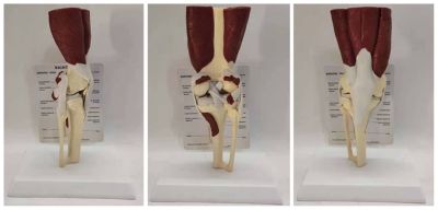 The human knee meniscus skeleton skeleton muscle model ligament structure medical teaching model