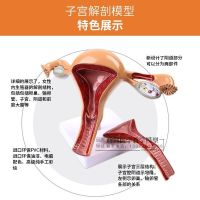 Pathological human medical AIDS anatomic lesions in the uterus uterus model teaching model