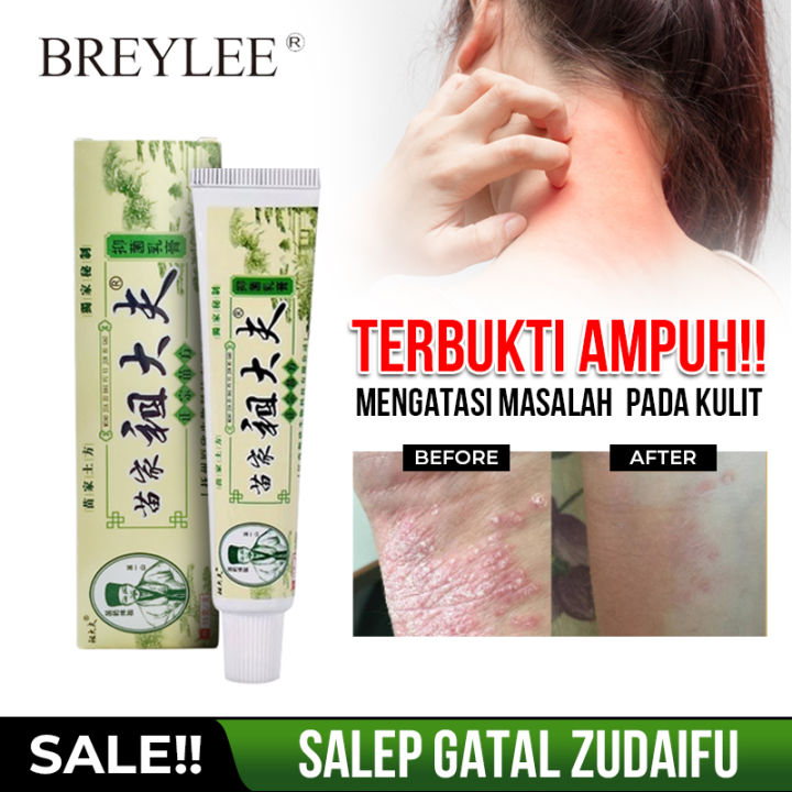 Promo Obat Gatal Kulit Paling Ampuh Salep Gatal Cina Ampuh Tanpa