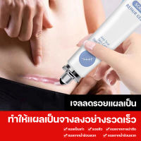 จัดส่งทันที ครีมลบแผลเป็น MSLAM Scar cream ครีมทาแผลเป็นจากน้ำลวก ครีมทาลอยแผลเป็น  เจลลบรอยแผลเป็น20g  เจลรักษาแผลเป็น รอยแผลผ่าตัด เหมาะใช้กับรอยสิว  เจลทาแผลเป็นนูน ครีมลบรอยแผลเป็น    ครีมดูแลรอยแผลเป็นต่างๆ