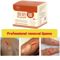 [Lipoma 101 Healing] 99% Cure Lipoma Removal Cream กำจัด Lipomas ใต้ผิวหนัง36ชนิดกำจัดก้อนมวลเพื่อ Atheroma Cyst 99% หลอด