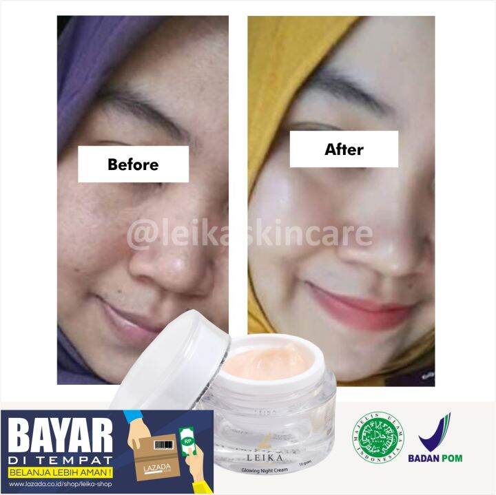 Cream Pelembab Wajah Kering dan Kusam BPOM Halal MUI TERBAIK Krim