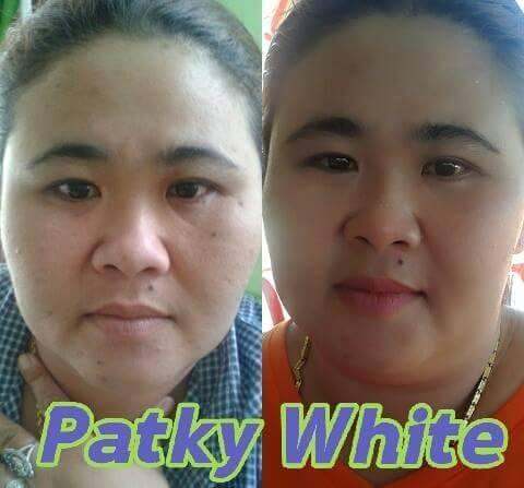 patky-white-แพ็คกี้ไวท์-ชุดครีม-สบู่ทับทิมคอลลาเจน-กลางวัน1-กลางคืน1-กันแดด1-สบู่1