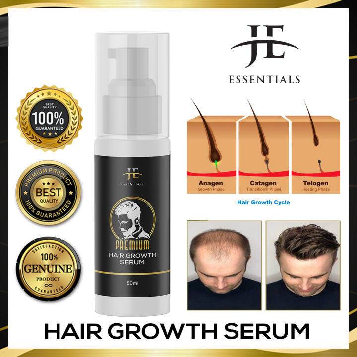 Hair Growth Oil Fast Hair Growth Effective Baldness Repair Hereditary Hair Loss Postpartum Hair 6680