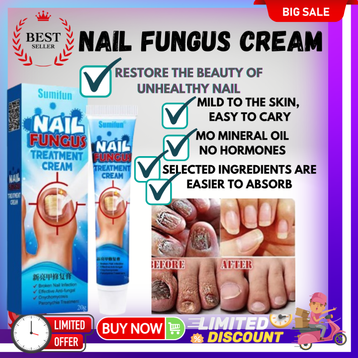 ️【 COD】SUMIFUN Nail Fungus Hand Foot Nail Antibacterial Care100 ...