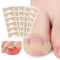 Ingrown Toenail Corrector Stickers Paronychia Treatment Pedicure Toe Nail Care Corrector Patch Correction Stickers 30Pcs