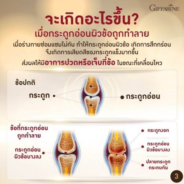 ส่งฟรี-ยูซีทู-กิฟฟารีน-ยูซี-ทู-โกลด์-uc-ii-giffarine-คอลลาเจนไทป์ทู-คลอลาเจนกระดูก-อันดีเนเจอร์-คอลลาเจน-ไทพ์ทู-ผสม-ไฮโดรไลซ์-คอลลาเจน