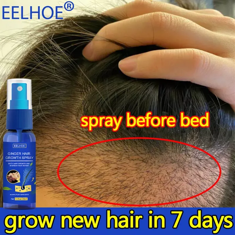 Regrowth Organic Hair Serum Best Price In Singapore Nov 2022 | Hair Growth  Fluid Spray Nourishing Intensive Anti-stripping Spray Anti-hair Loss Serum  30ml 