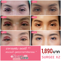 Surgee เซอร์จี้ 2 กล่อง อาหารเสริมลดบวมช้ำเร่งสมานแผลหลังผ่าตัด