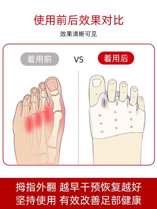 japanese-toe-corrector-toe-splitter-hallux-valgus-toe-corrector-silicone-gel-toe-separator-wearing-shoes