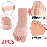 1คู่ ชุดดูแลเท้าหลุมรังผึ้งเบาะด้านหน้าแยกห้านิ้ว hallux valgus กระดูกเท้าขนาดใหญ่ทับซ้อนการดูดซึม