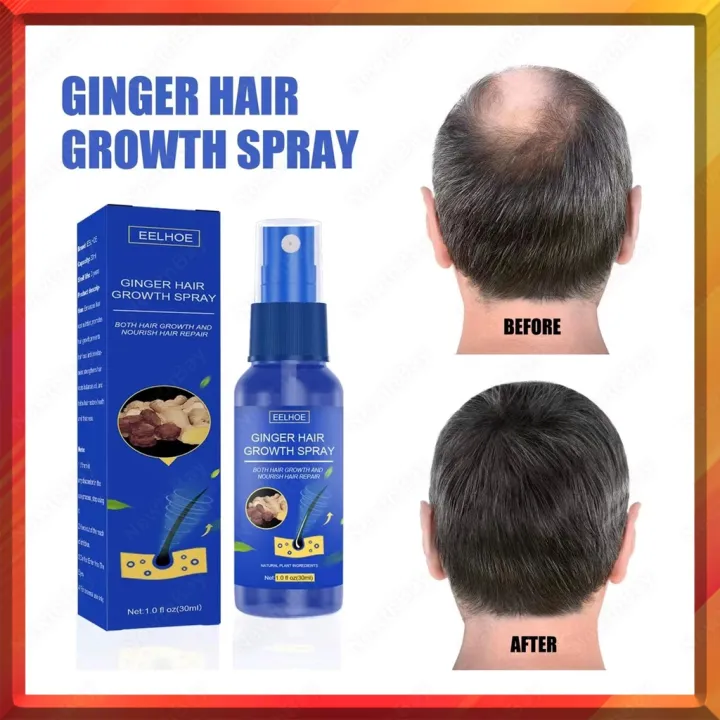 30ml Intensive Hair Growth Treatment Serum ,Spray , Clinically Proven