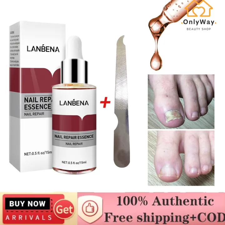นาฬิกา LANBENA Nail Repair Essence การรักษาเล็บเชื้อราเซรั่มกำจัด