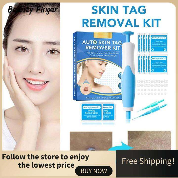BEAUTY FINGER Foot Care Tools Plantar Warts Foot Corn Removal Body