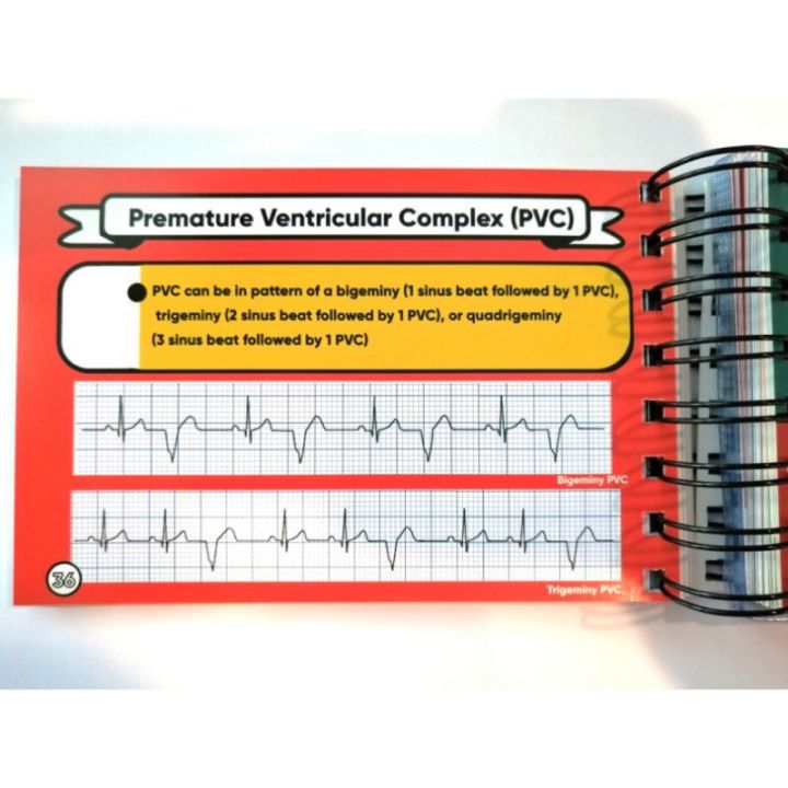 ขายดี-หนังสือ-a-beginners-plearn-with-ekg-electrocardiography-ezy-card-the-review-book-of-practical-ecg-ตำราแพทย์-บริการเก็บเงินปลายทาง