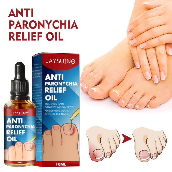 Anti Paronychia Relief Oil Ingrown Toenail Drops Anti Fungal Toe Nail