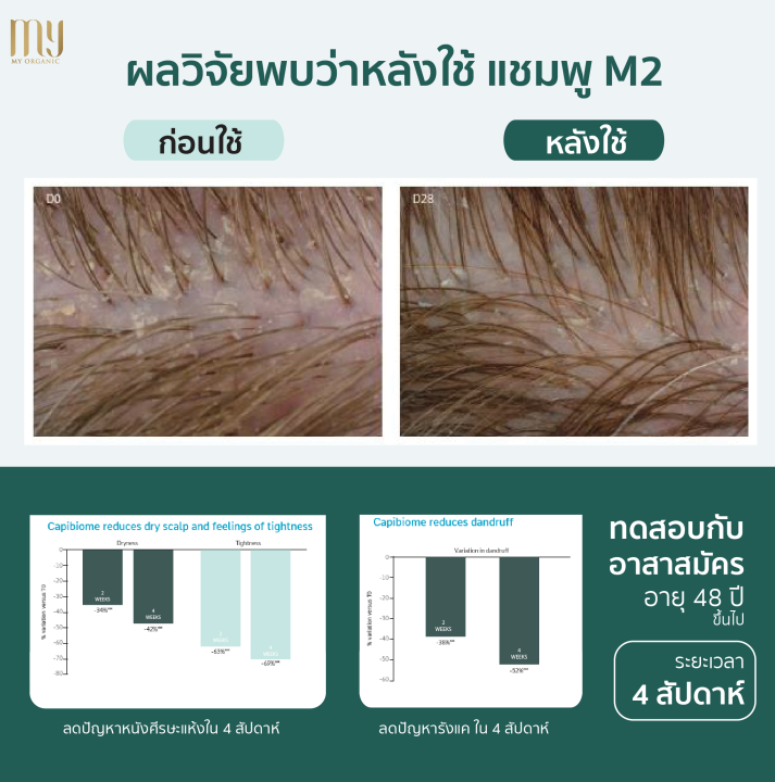 แชมพู-ผมร่วง-ผมบาง-กำจัดรังแค-m2-แบรนด์-my-organic