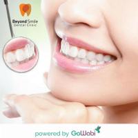 Beyond Smile Dental Clinic - Dental Check up + Dental X-ray + Scaling + Cleaning + Fluoride Treatment