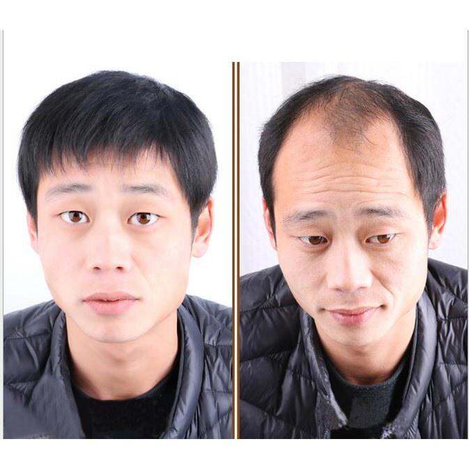 middle-aged-man-wig-dad-wig-natural-short-hair-black-100-real-hair-man-wig-handmade-bald-patch