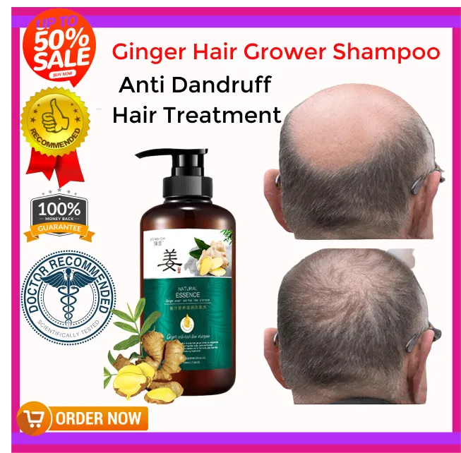 BEST SELLER EFFECTIVE Natural Essence Ginger Shampoo | Herbal Plant Essence  Hair500ml Ginger Juice Hair Growth