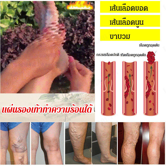 luoaa01-เท้าร้อนสุขภาพดีสำหรับเด็กชาย