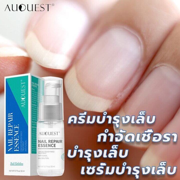 auquest-เชื้อราเล็บมือ-ยาทาแก้เชื้อราที่เล็บ-น้ำยารักษาเล็บ-รักษาเล็บเสีย