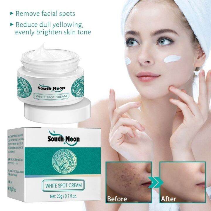 Meili Yunnan Melasma Cream Yunnan Herbal Whitening Freckle Cream ...