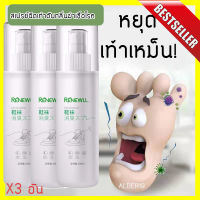 ALDER19 X3 แพ็คสุดคุ้ม Renewall Foot spray สเปร์ยฉีดเท้าดับกลิ่นฆ่าเชื้อโรค สเปร์ยดับกลิ่นเท้า เท้าเหม็น กลิ่นหอม สเปรย์ฉีดเท้า สเปรย์ฉีดรองเท้า รองเท้าเหม็น กลิ่นไม่พึงประสงค์ ตีนเหม็น Foot deodorant