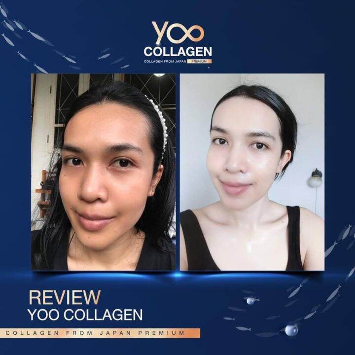 ยู-คอลลาเจน-yoo-collagen-110-กรัม-1-กระปุก-คอลลเจน-ที่-บอยพิษณุ-ยูคอลลาเจน-คอลลเจน-ผิวลื่น-ผิวไม่แห้ง-ไม่มีน้ำตาล-collagen-ขนาด-110-0000มก-พร้อมส่ง