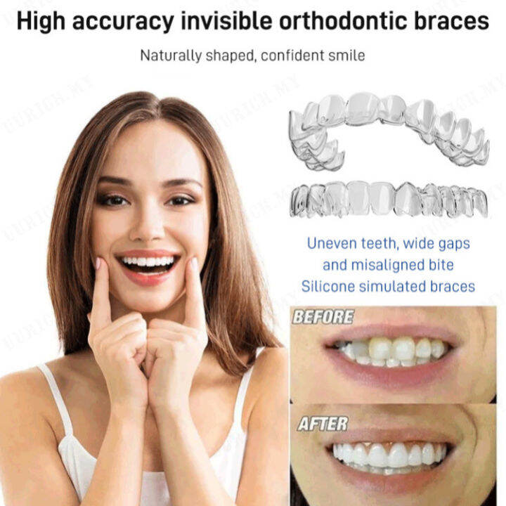 ganze011 New sixth generation upper and lower teeth simulation braces
