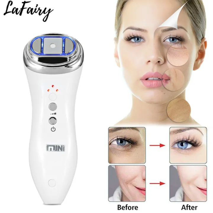 LAFAIRY Ultrasonic Bipolar RF Facial Machine Lifting Face Neck Skin ...