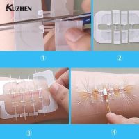 【LZ】mm8463327le8826 1/2/10Pcs Zipper Tie Wound Closure Patch Hemostatic Patch Wound Fast Suture Zipper Band-Aid Outdoor Portable Skin Care