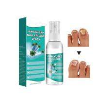 Nail Care Spray 30ml Odor Cleaning Healthy Nail Solution Repairing Brightening Safe Nail Liquid Nail Care for Separated Nails handsome