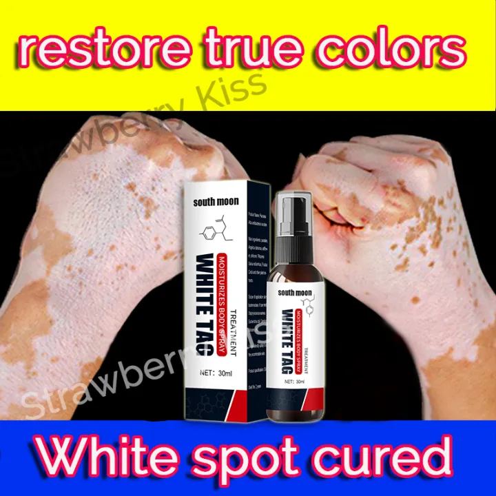 【Vitiligo nemesis】South Moon mustard oil for vitiligo remover treatment