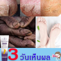 Aichun ครีมบำรุงเท้า 100ml ครีมทาเท้าแตก ป้องกันรอยแตกเท้า ซ่อมแซมส้นเท้าแห้งแตก แห้ง หยาบ หนังแข็ง ครีมทาส้นทาแตก ครีมทาส้นเท้า ทาส้นเท้าแตก ส้นท้าวแตก ครีมทาส้นเท้าแตก ครีมทาเท้าขาว ครีมทาส้นเท้า ครีมทาเท้า ยาทาส้นเท้าแตก ครีมส้นเท้าแตก