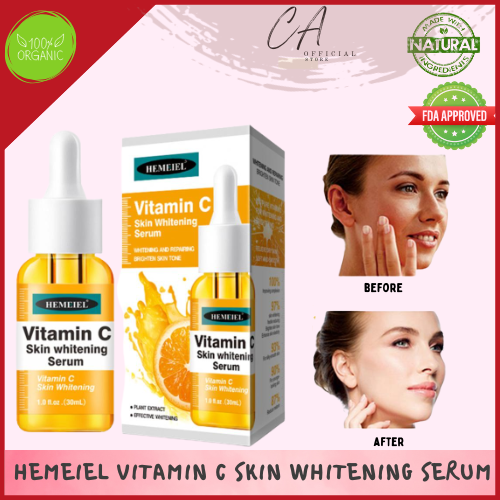 Vitamin C Serum/Melasma and Pekas Remover/Dark Spots/Whitening ...