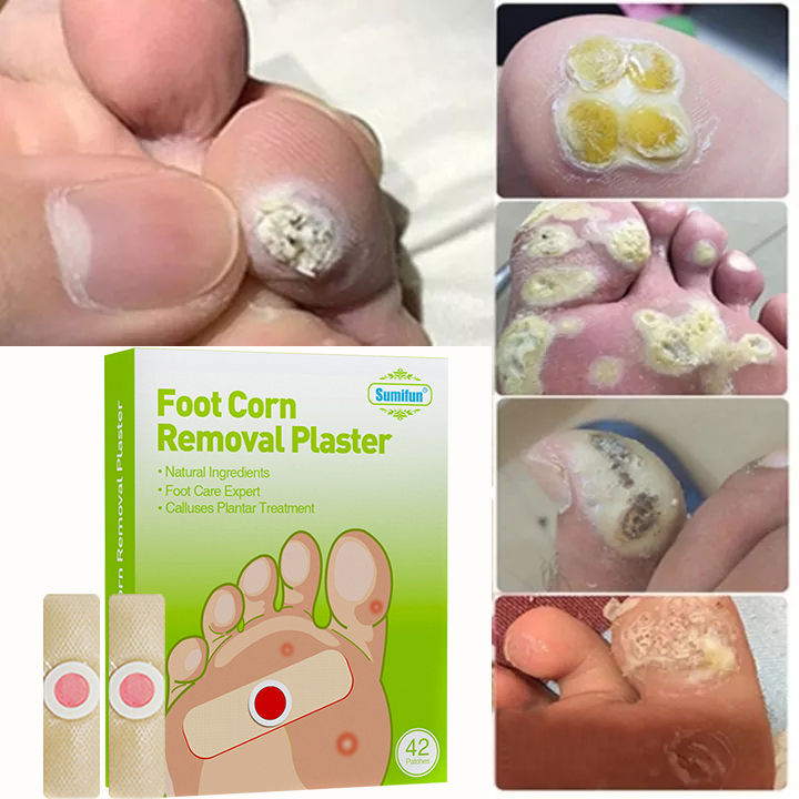 Feet Corns Warts Removal Patch Quick Pain Relief Remover Old Cocoon