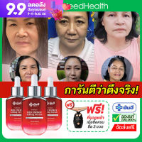 (หมดอายุ 12/05/2025) เซรั่มยันฮีแท้ ยันฮีเซรั่มแดง เรดเอนเนอร์จี้ Yanhee Red Energy Serum ของแท้ เซรั่มยกกระชับ เซรั่มหน้าตึง ขนาด 30ml ส่งฟรี iNeedHealth