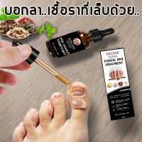 เซรั่มเล็บ เซรั่มซ่อมแซมเล็บ Nail Fungal Infection ยาแก้เชื้อราที่เล็บ ยากันเชื่อราเล็บ บำรุงเล็บเสีย บำรุงเล็บมือ（น้ำมันบำรุงเล็บ ครีมบำรุงเล็บ ยาแก้เล็บขบ เชื้อราเล็บมือ ยาหยอดเล็บ ครีมบำรุงซ่อมแซมเล็บ ครีบบำรุงเล็บ เซรั่มเชื้อราเล็บ น้ำยาเล็บขบ）