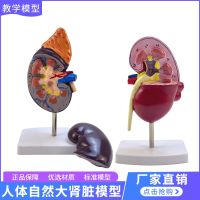 Renal pathological structure model human gut natural specimens of large renal anatomy of the adrenal model kidney AIDS